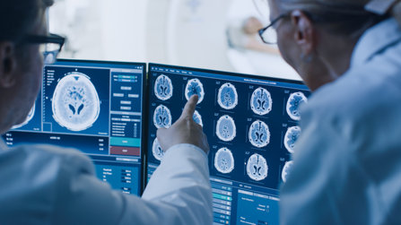 Radiologist discuss brain scans results