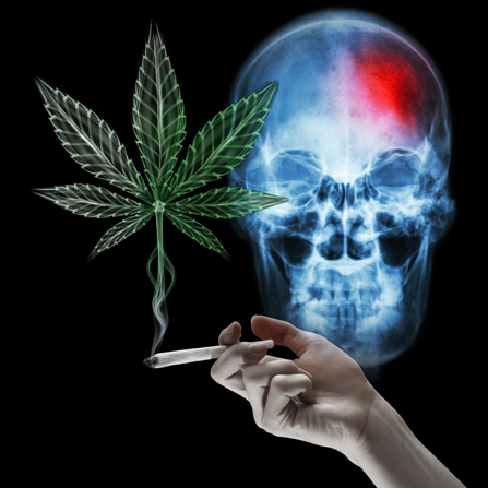 Marijuana have something to do with stroke.