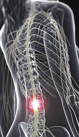 Alcoholism Nervous System Damage