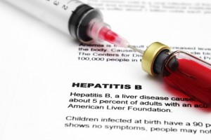 hepatitis